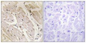 Immunohistochemical analysis of paraffin-embedded human heart tissue using Anti-PRKAG2 Antibody. The right hand panel represents a negative control, where the antibody was pre-incubated with the immunising peptide.