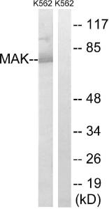 Western blot analysis of lysates from K562 cells using Anti-MAK Antibody The right hand lane represents a negative control, where the antibody is blocked by the immunising peptide