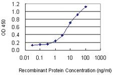 Anti-MIPOL1 Mouse Monoclonal Antibody [clone: 1B7]