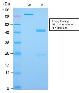 SDS-PAGE analysis of Anti-CDX2 Antibody [CDX2/2951R] under non-reduced and reduced conditions; showing intact IgG and intact heavy and light chains, respectively. SDS-PAGE analysis confirms the integrity and purity of the antibody.