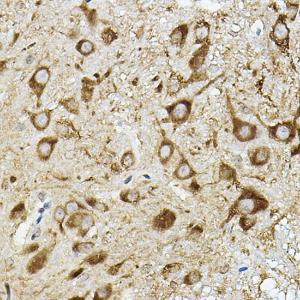 Immunohistochemistry analysis of paraffin-embedded mouse spinal cord using Anti-ATP6V1G2 Antibody (A305403) at a dilution of 1:50 (40x lens). Perform high pressure antigen retrieval with 10 mM citrate buffer pH 6.0 before commencing with IHC staining protocol.