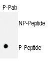 Anti-ITGA5 Rabbit Polyclonal Antibody