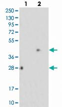 Anti-PARP11 Rabbit Polyclonal Antibody