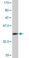 Anti-BMPR2 Mouse Monoclonal Antibody [clone: 4G7]