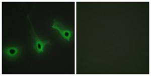 Immunofluorescence analysis of HeLa cells using Anti-Collagen V alpha3 Antibody. The right hand panel represents a negative control, where the Antibody was pre-incubated with the immunising peptide