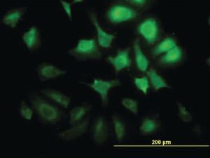 Anti-CCNG2 Mouse Monoclonal Antibody [clone: 1F9-C11]