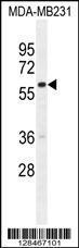 Anti-GNL3L Rabbit Polyclonal Antibody (Biotin)