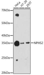 Western blot analysis of extracts of various cell lines, using Anti-NPHS2 Antibody [ARC1907] (A305404) at 1:1,000 dilution