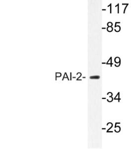 Western blot analysis of lysate from MCF 7 cells using Anti-PAI-2 Antibody