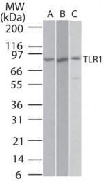 Anti-TLR1 Rabbit Polyclonal Antibody