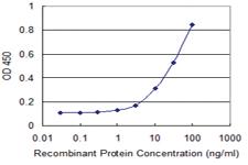 Anti-MUSK Mouse Monoclonal Antibody [clone: 4C4]