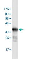 Anti-DDX41 Mouse Monoclonal Antibody [clone: 1D4]