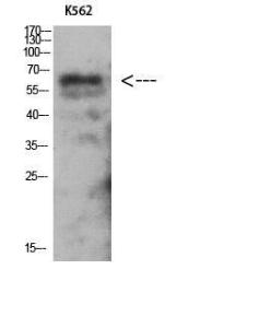 Western blot analysis of K562 using Anti-PRKAG2 Antibody