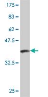 Anti-APCS Mouse Monoclonal Antibody [clone: 4E8]