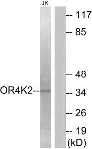 Western blot analysis of lysates from Jurkat cells using Anti-OR4K2 Antibody. The right hand lane represents a negative control, where the antibody is blocked by the immunising peptide