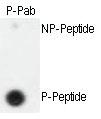 Anti-MORN5 Rabbit Polyclonal Antibody