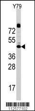 Anti-LAMP1 Rabbit Polyclonal Antibody (AP (Alkaline Phosphatase))