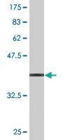 Anti-APCS Mouse Monoclonal Antibody [clone: 4F3]