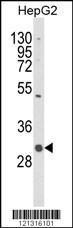 Anti-C1QTNF6 Rabbit Polyclonal Antibody (APC (Allophycocyanin))