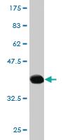 Anti-SCAMP3 Mouse Monoclonal Antibody [clone: 1F6]