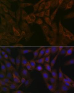 Immunofluorescence analysis of NIH-3T3 cells using Anti-ARF5 Antibody [ARC1960] (A309207) at a dilution of 1:100 (40x lens) DAPI was used to stain the cell nuclei (blue)