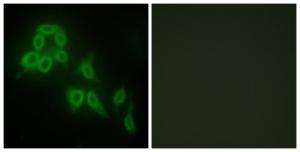 Immunofluorescence analysis of HepG2 cells using Anti-Collagen V alpha2 Antibody. The right hand panel represents a negative control, where the antibody was pre-incubated with the immunising peptide