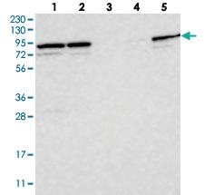 Anti-PARP6 Rabbit Polyclonal Antibody