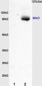 Anti-SMO Rabbit Polyclonal Antibody