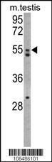 Anti-MRII Rabbit Polyclonal Antibody (Biotin)