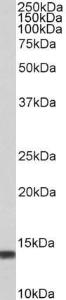 Anti-S100A4 antibody