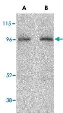 Anti-NOD2 Rabbit Polyclonal Antibody