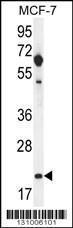 Anti-hCG_1646420 Rabbit Polyclonal Antibody (FITC (Fluorescein Isothiocyanate))