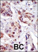 Anti-PIP4K2C Rabbit Polyclonal Antibody (AP (Alkaline Phosphatase))