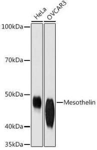 Anti-Mesothelin Rabbit Monoclonal Antibody [clone: ARC1464]