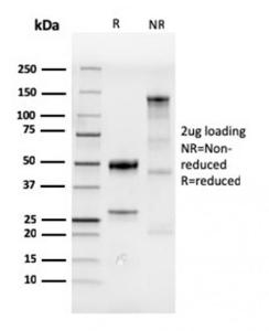 SDS-PAGE analysis of Anti-CDX2 Antibody [CDX2/4394R] under non-reduced and reduced conditions; showing intact IgG and intact heavy and light chains, respectively SDS-PAGE analysis confirms the integrity and purity of the antibody