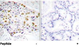 Anti-RB1 Rabbit Polyclonal Antibody