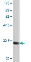 Anti-GBA3 Mouse Polyclonal Antibody