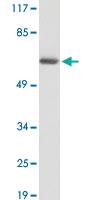 Anti-PDLIM5 Rabbit Polyclonal Antibody