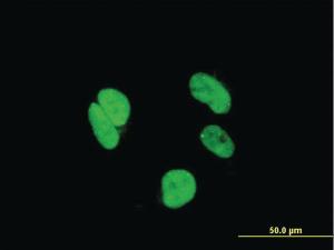 Anti-RAX Mouse Monoclonal Antibody [clone: 3G8]