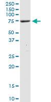 Anti-XRCC1 Rabbit Polyclonal Antibody