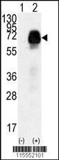 Anti-MRII Rabbit Polyclonal Antibody