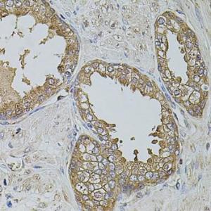 Immunohistochemistry of paraffin-embedded human prostate using Anti-KTN1 Antibody (A5879) at dilution of 1:100 (40x lens)