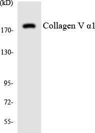 Western blot analysis of the lysates from HUVEC cells using Anti-Collagen V alpha1 Antibody