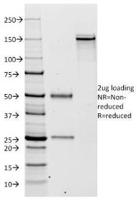 SDS-PAGE analysis of Anti-Kappa Light Chain Antibody [KLC264] under non-reduced and reduced conditions; showing intact IgG and intact heavy and light chains, respectively. SDS-PAGE analysis confirms the integrity and purity of the antibody