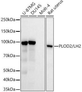 Western blot analysis of extracts of various cell lines, using Anti-PLOD2 / LH2 Antibody [ARC54359] (A306311) at 1:30000 dilution