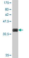 Anti-PLAG1 Mouse Polyclonal Antibody