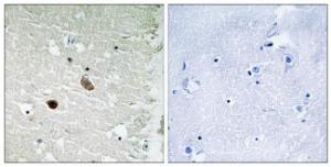 Immunohistochemical analysis of paraffin-embedded human brain tissue using Anti-CaMK2 beta + gamma + delta Antibody. The right hand panel represents a negative control, where the antibody was pre-incubated with the immunising peptide