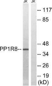 Western blot analysis of lysates from Jurkat cells using Anti-PPP1R8 Antibody. The right hand lane represents a negative control, where the antibody is blocked by the immunising peptide.