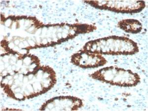 Immunohistochemical analysis of formalin-fixed, paraffin-embedded human colon using Anti-CDX2 Antibody [CDX2/4394R]