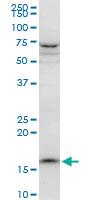 Anti-PPIL1 Mouse Polyclonal Antibody